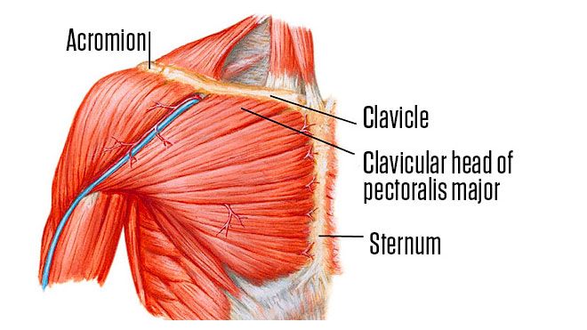 CHEST WORKOUT ESSENTIALS – 3 KEYS TO UNLOCKING THE "TREASURE" CHEST!