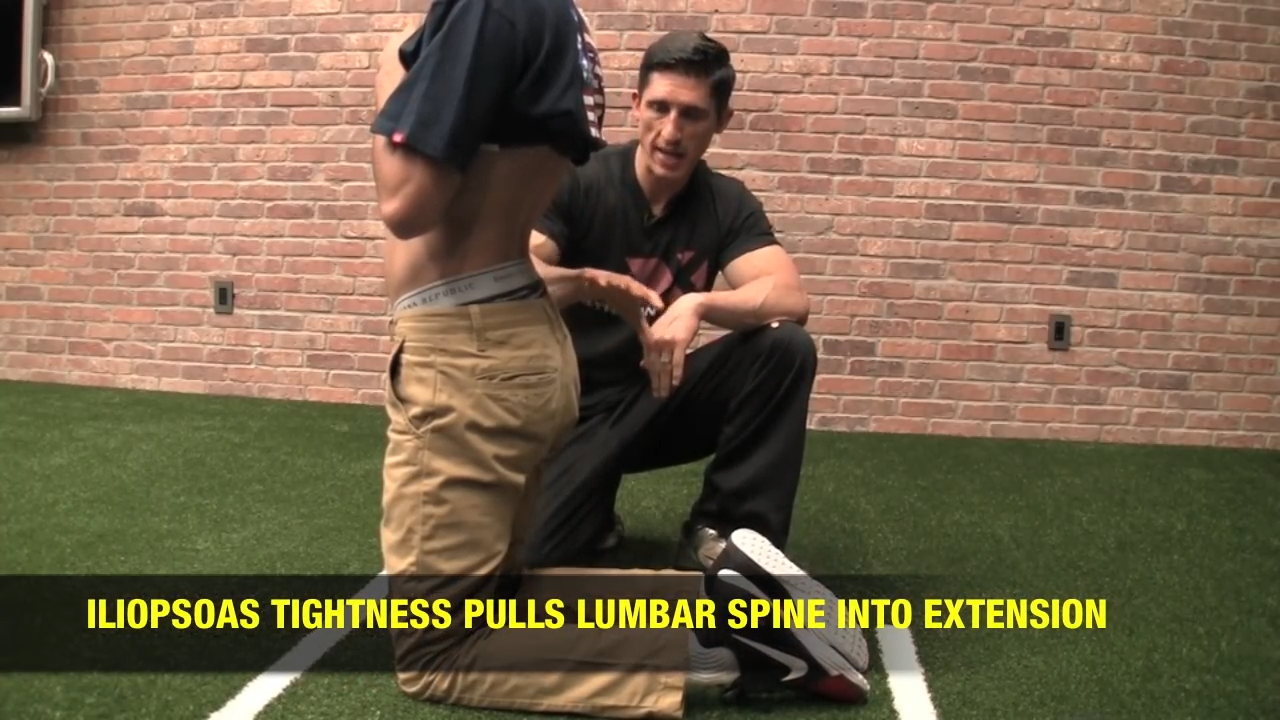 How to Fix Anterior Pelvic Tilt