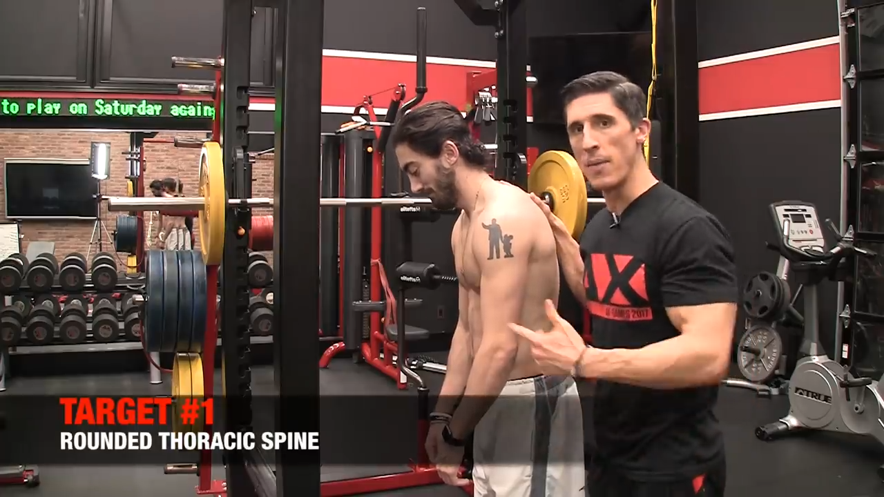 rounded thoracic spine posture problem