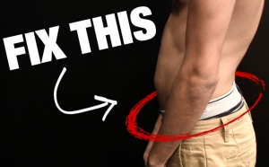 how to fix anterior pelvic tilt