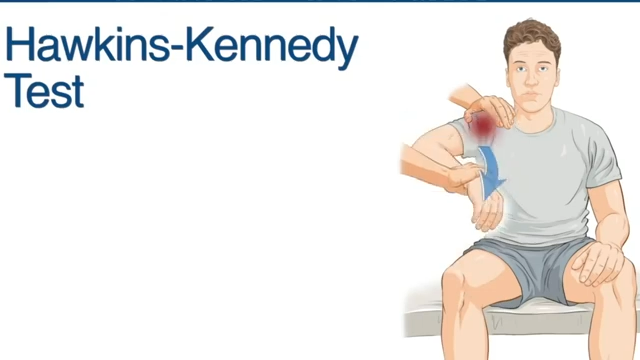 hawkins kennedy test shoulder impingement